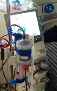 一次性使用樹脂灌流器