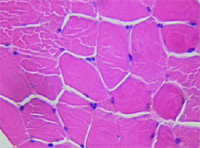 肌細胞