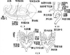 先天性主動脈弓畸形