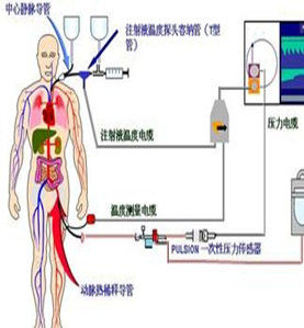 血流動力學 血流動力學
