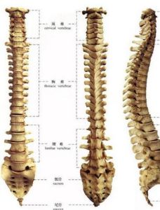腰椎滑脫症 腰椎滑脫症