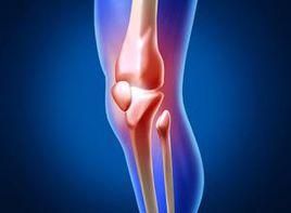 膝後腫脹疼痛,活動受限 膝後腫脹疼痛,活動受限