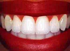 白天不自覺地將牙咬緊 白天不自覺地將牙咬緊