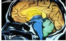 恐懼(別名：驚慌害怕)