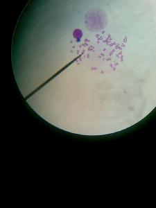 超數染色體 超數染色體