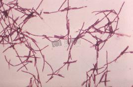 細菌芽孢形成 細菌芽孢形成