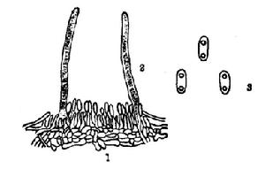 （圖）病原真菌