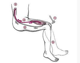 膝腱反射消失 膝腱反射消失
