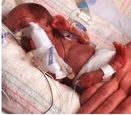 先天性皮膚缺失 先天性皮膚缺失