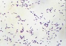 伴放線放線桿菌