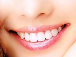 鎳鎘烤瓷牙 鎳鎘烤瓷牙