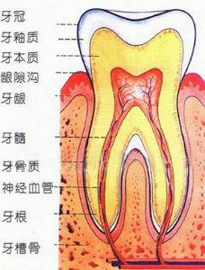 慢性牙齦炎