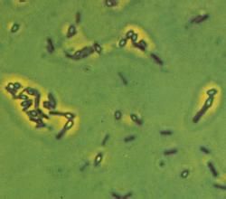 兼性厭氣細菌 兼性厭氣細菌