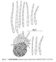 千屈菜科假尾孢 千屈菜科假尾孢