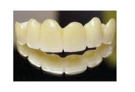 烤瓷牙套 烤瓷牙套