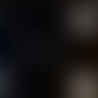 IC 379 RASS 彩色圖