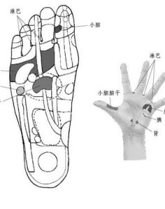 肢體麻木 肢體麻木
