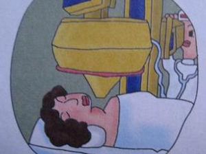 垂體性甲亢 垂體性甲亢