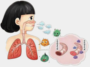 兒童性哮喘 兒童性哮喘