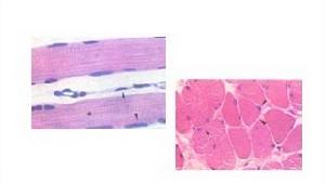 橫紋肌I帶 橫紋肌I帶