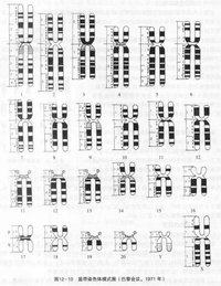 染色體數目變異