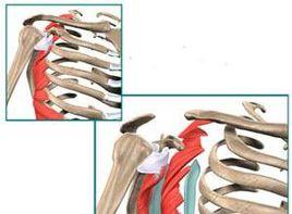 肩帶肌上肢和胸背部諸肌的肌無力和肌萎縮