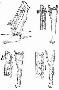 大隱靜瓣膜功能實驗 大隱靜瓣膜功能實驗