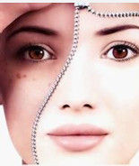 面部色斑 面部色斑