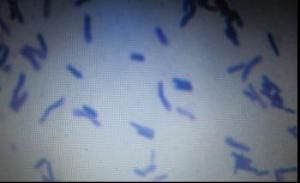 脂環酸芽孢桿菌屬 脂環酸芽孢桿菌屬