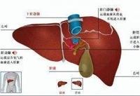 廣東肝病研究院