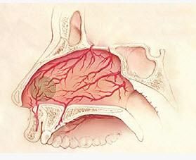 利特爾區 利特爾區