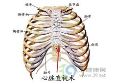 繼發性縱隔感染