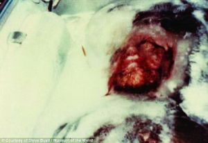 明尼蘇達雪怪 明尼蘇達雪怪