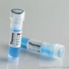 環腺苷酸受體蛋白 環腺苷酸受體蛋白