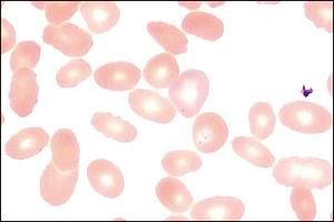 附紅細胞體病 附紅細胞體病