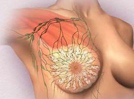 乳房內光滑質韌的球形腫塊 乳房內光滑質韌的球形腫塊