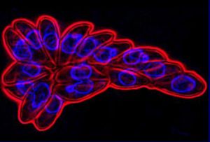 剛地弓形蟲 剛地弓形蟲