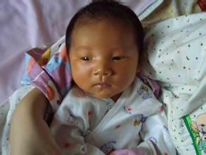 生理性黃疸 生理性黃疸