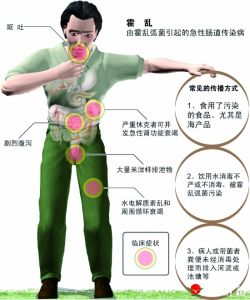 霍亂的傳播方式和症狀