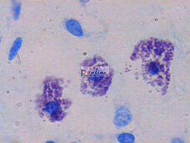 甲苯胺藍 甲苯胺藍