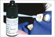 粘接劑均勻地塗抹於根管內