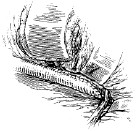 腹腔乾動脈瘤 腹腔乾動脈瘤