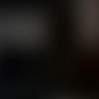 IC 594 RASS 彩色圖