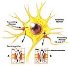 癔症性朦朧狀態 癔症性朦朧狀態