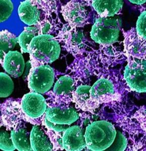 非溶源性細菌 非溶源性細菌