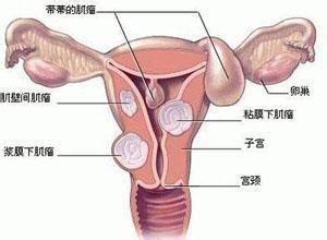 子宮內膜增厚