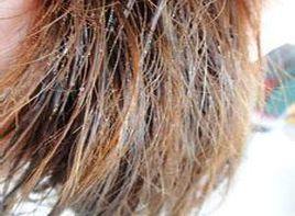 毛髮乾燥易斷 毛髮乾燥易斷