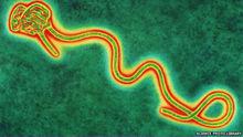伊波拉病毒
