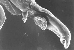 血吸蟲---這是寄生蟲血吸蟲的掃描電子顯微照片。成年