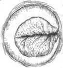 子宮頸外翻 子宮頸外翻